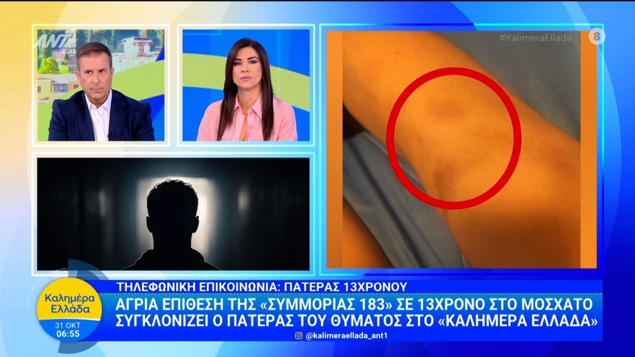 Μια επίθεση σε 13χρονο στο Μοσχάτο προκαλεί σοκ