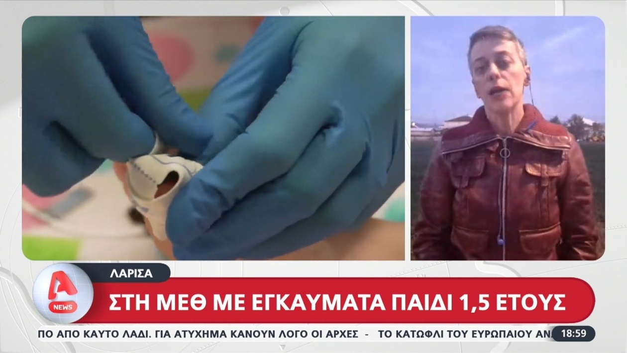 Στη Λάρισα παιδί 1,5 έτους στη ΜΕΘ με σοβαρά εγκαύματα