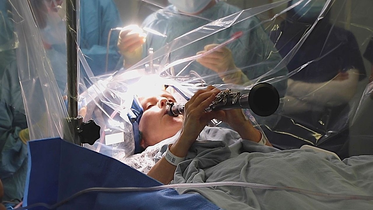 Πάρκινσον: Η μελωδία της ελπίδας στην επέμβαση εγκεφάλου