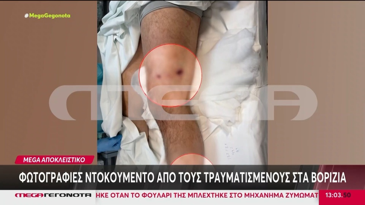 Φωτογραφικό ρεπορτάζ των τραυματιών στα Βορίζια