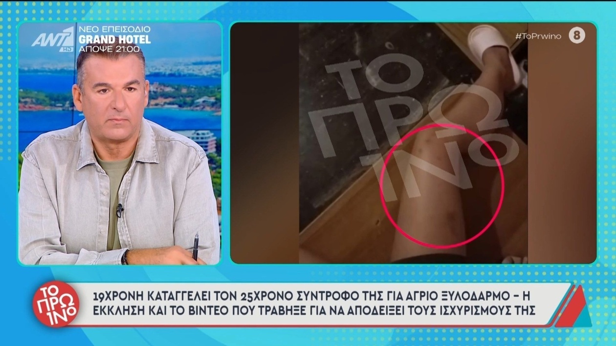 19χρονη γυναίκα καταγγέλλει σοβαρό ξυλοδαρμό από τον σύντροφό της