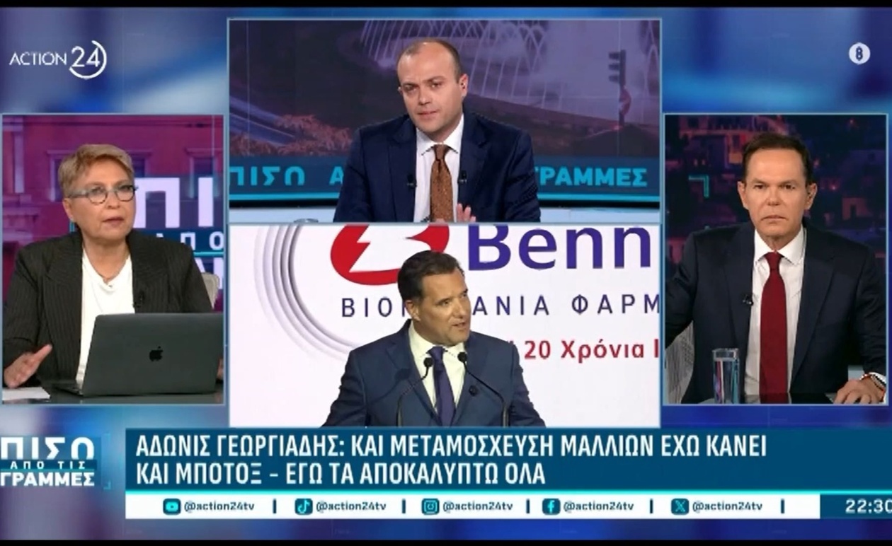 Ο Άδωνις Γεωργιάδης αποκαλύπτει προσωπικές παρεμβάσεις στην εμφάνισή του