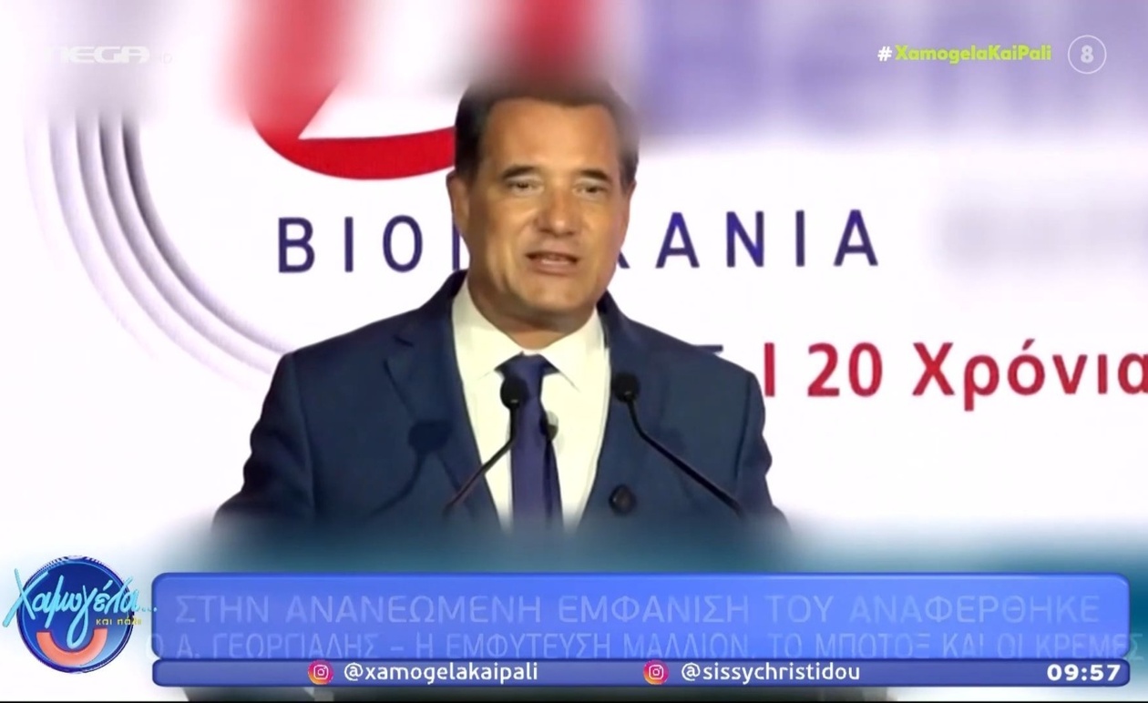 Ο Άδωνις Γεωργιάδης μιλά ανοιχτά για τις αισθητικές παρεμβάσεις