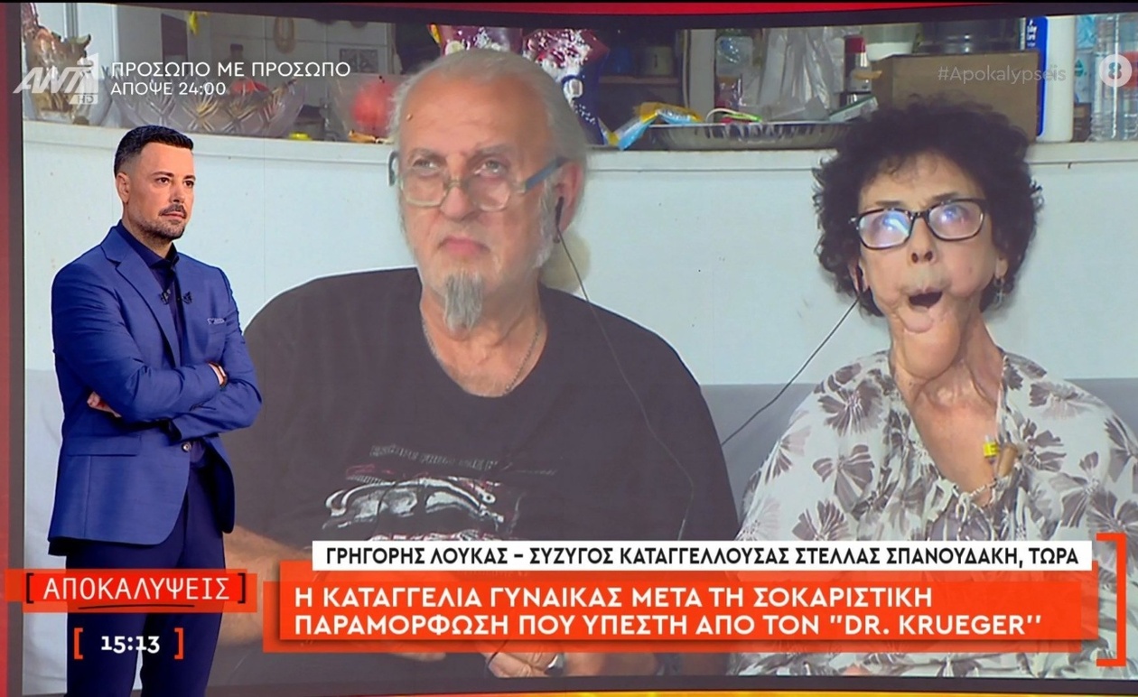 Η καταγγελία γυναίκας για σοβαρή παραμόρφωση μετά επέμβασης που αποδίδει στον “Dr Krueger”