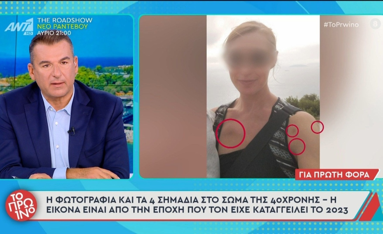 Η φωτογραφία με τα σημάδια στο σώμα της 40χρονης που προβλήθηκε στην τηλεόραση
