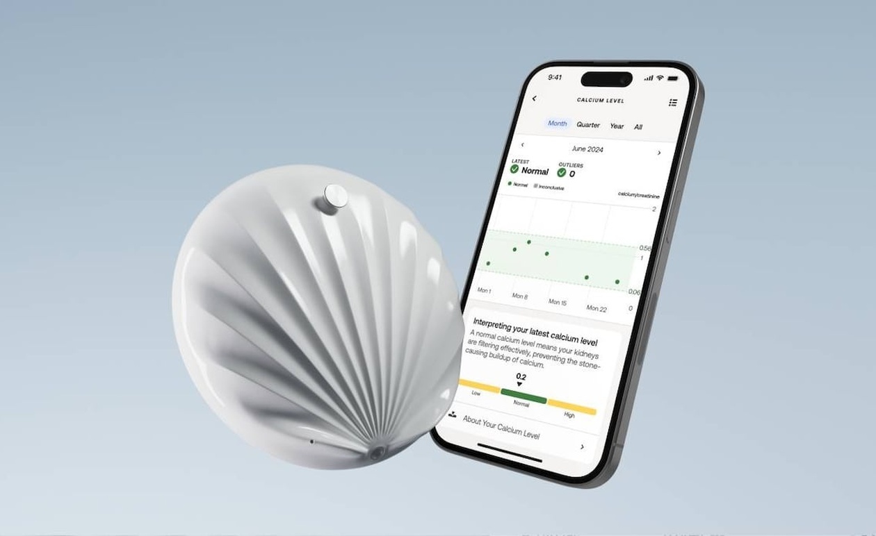 Το Withings U-Scan Nutrio φέρνει ανάλυση ούρων στο σπίτι