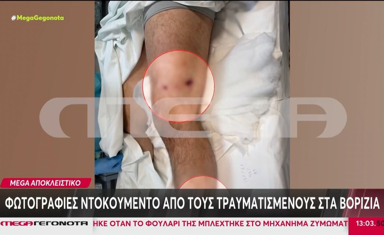 Φωτογραφικό ρεπορτάζ των τραυματιών στα Βορίζια