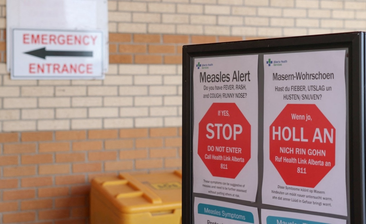 Ο Καναδάς έχασε την κατάσταση εξάλειψης της ιλαράς μετά από σχεδόν τριάντα χρόνια