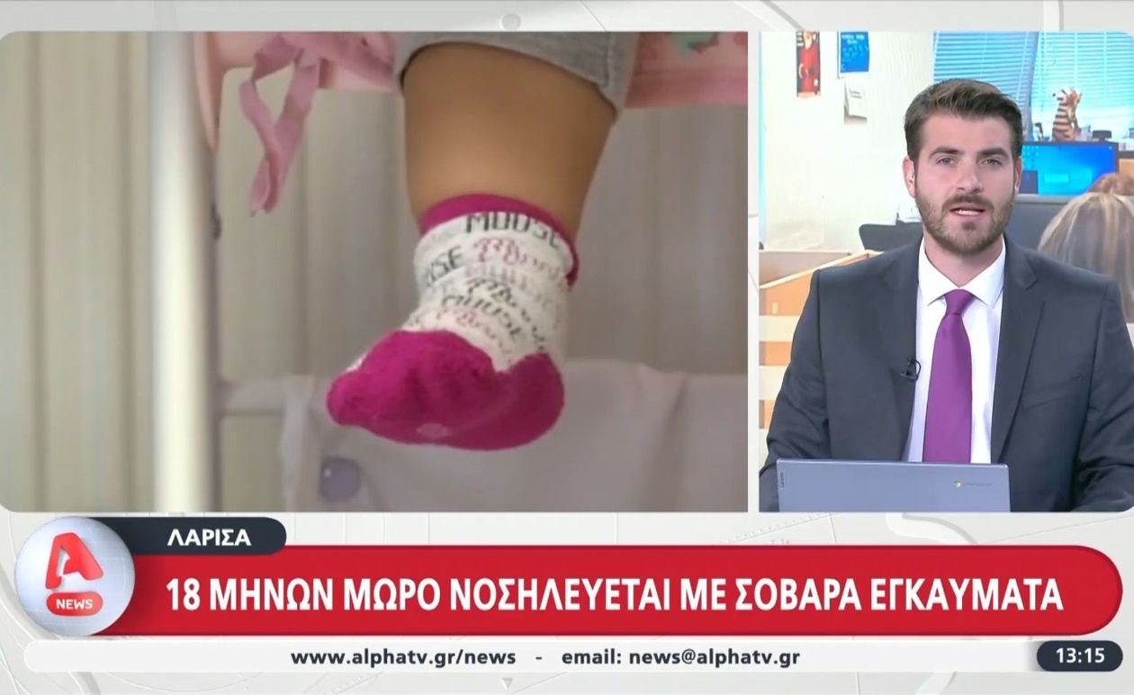 Ένα βρέφος 18 μηνών νοσηλεύεται στη Λάρισα με σοβαρά εγκαύματα