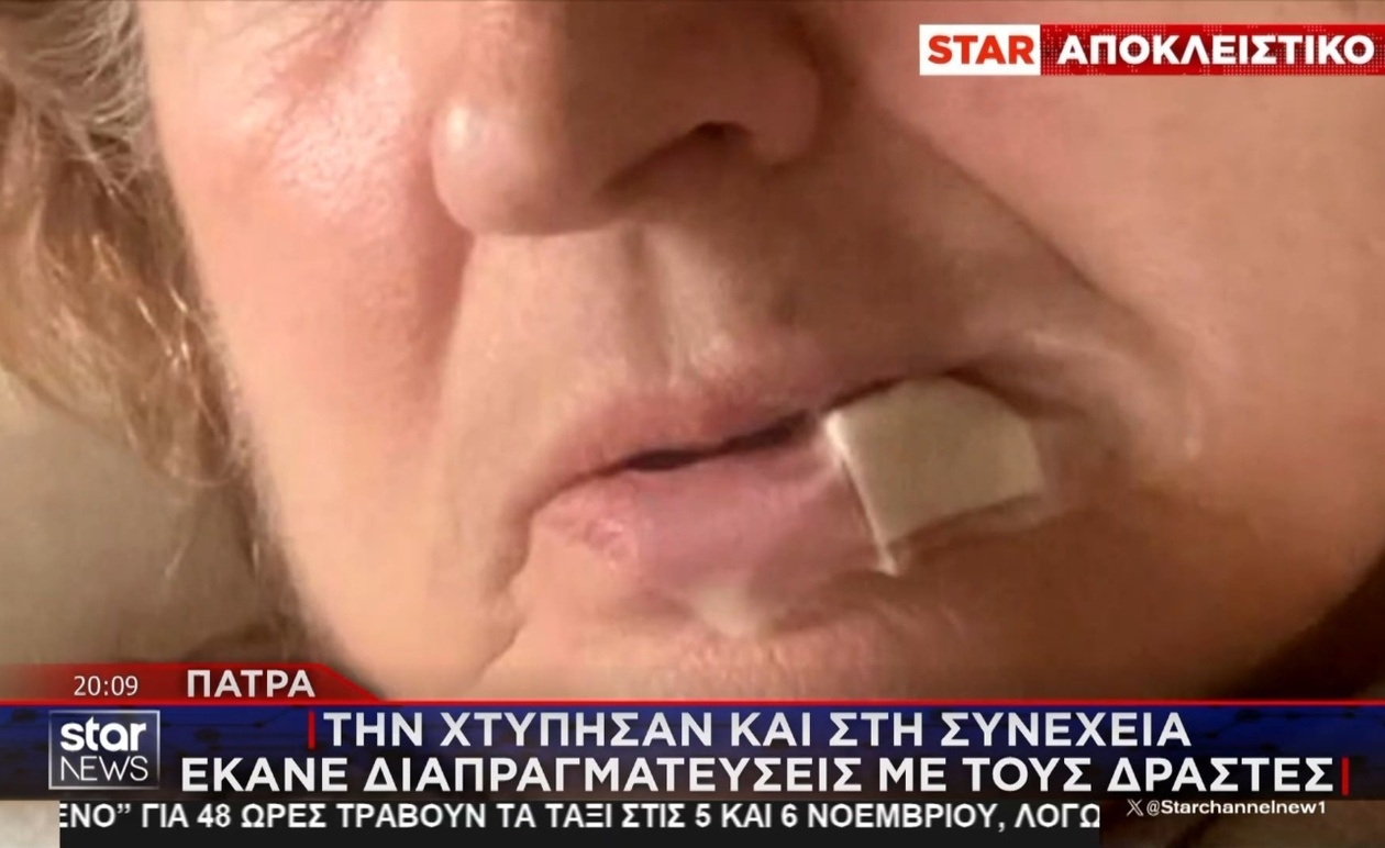 Στην Πάτρα, ανήλικοι περικύκλωσαν γυναίκα οδηγό και τη λήστεψαν