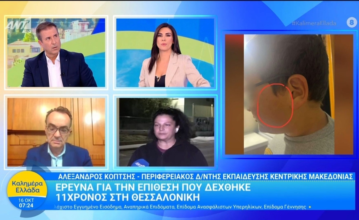 Η επίθεση κατά 11χρονου στη Θεσσαλονίκη και η έρευνα των αρχών