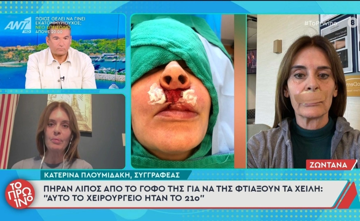 Η Κατερίνα Πλουμιδάκη αποκαλύπτει το συγκλονιστικό ταξίδι των 21 χειρουργείων